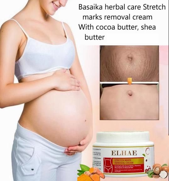 Stretch Mark Removal Cream (Pack of 2)