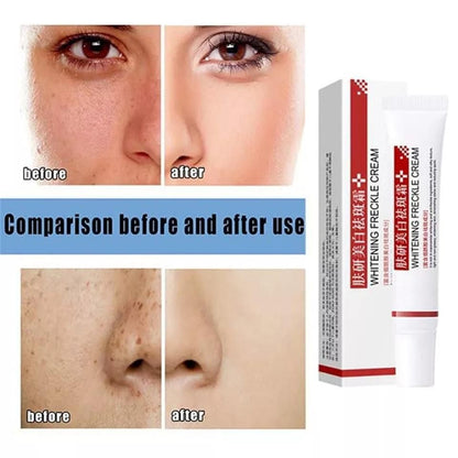 Effective Whitening Freckle Cream