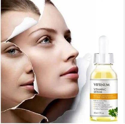 Serum for Face Brightening Skin with Vitamin B & Hyaluronic Acid, Anti Aging 30ml