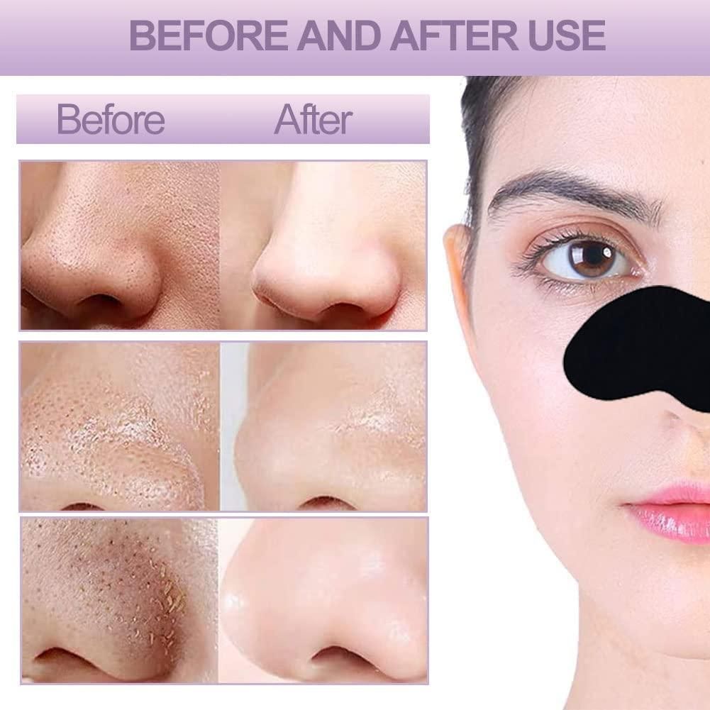 Deep Cleansing Blackhead Remover Strips (Pack of 20)